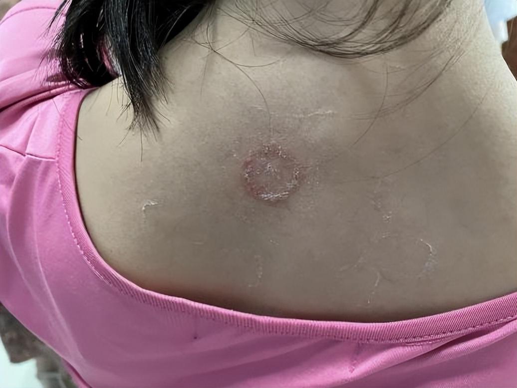 尤卓爾軟膏價(jià)格大解密，重磅揭秘真實(shí)價(jià)格??